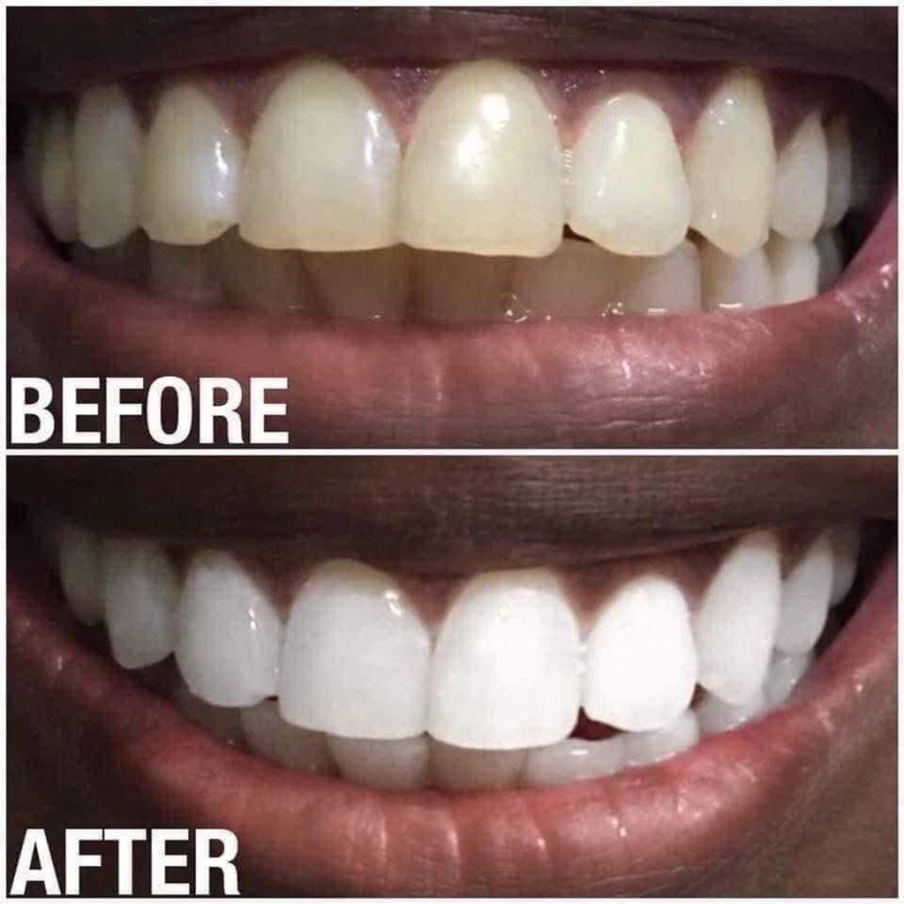 Whitening Toothpaste - Picture 2 of 5